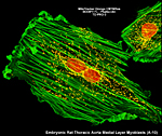 Embryonic Rat Thoracic Aorta Medial Layer Myoblasts (A-10)